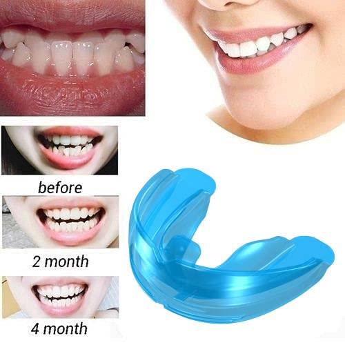 Maxxlite Portable Invisible Braces Correction Buck Teeth Dental Appliance Dental Trainer Tooth Correction Oral Orthodontic Appliance Trainer Braces Buck Teeth